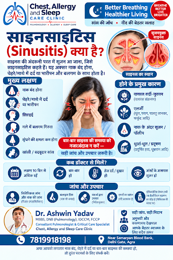 साइनसाइटिस (Sinusitis) —