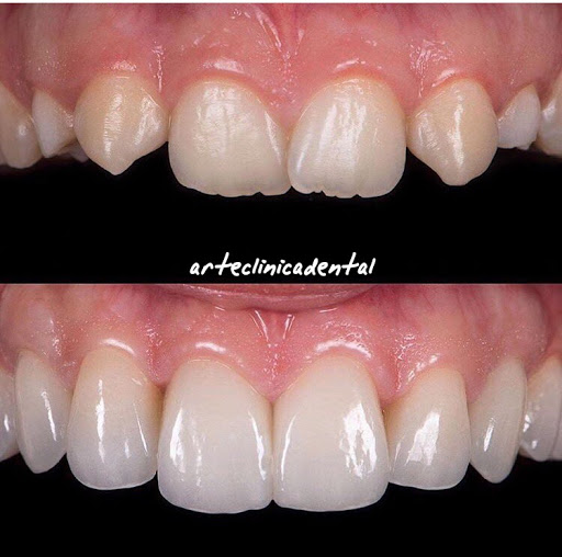 ARTE CLINICA DENTAL - Thumbnail
