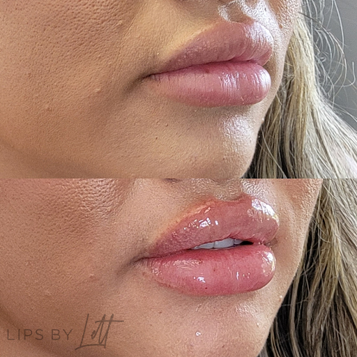 Fine Tuned Aesthetics (formerly Lips By Lett)