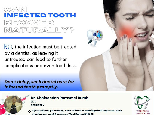 Can An Infected Tooth Heal Itself? post image
