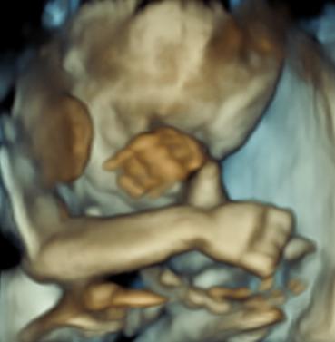 Rai Diagnostics - An Advance Ultrasound centre with Elastography Holter ECG TMT X-ray & Lab Services