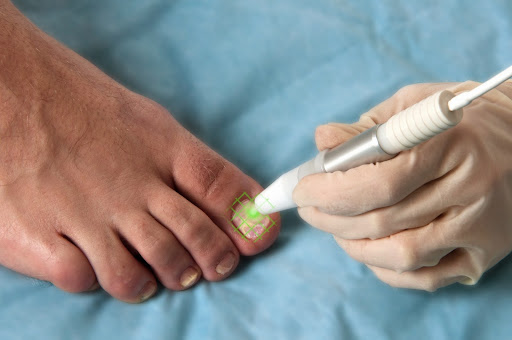 Casey Allied Health - Laser Clinic - Thumbnail