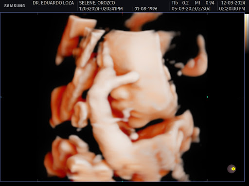 DR. EDUARDO LOZA ACEVES - Thumbnail