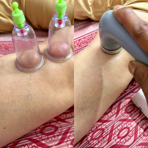 Knee pain treatment post image