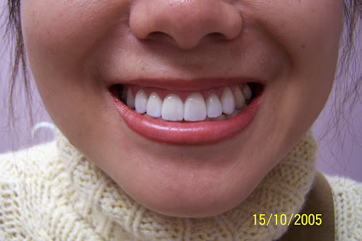 Dentistry On Taunton Ajax - Thumbnail
