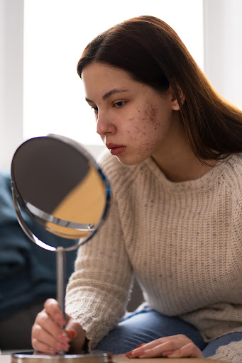 Skin disorders encompass a wide range of conditions that can affect the appearance, comfort, and… post image