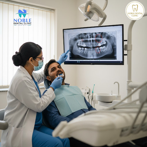 Dental X-rays play a crucial role in detecting problems that are not visible during a regular den… post image