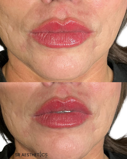 SR Aesthetics, LLC