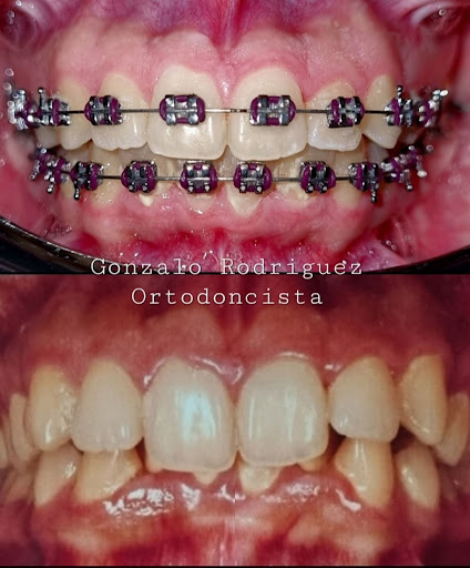COE Clínica Dental Ocuiltzapotlan - Thumbnail