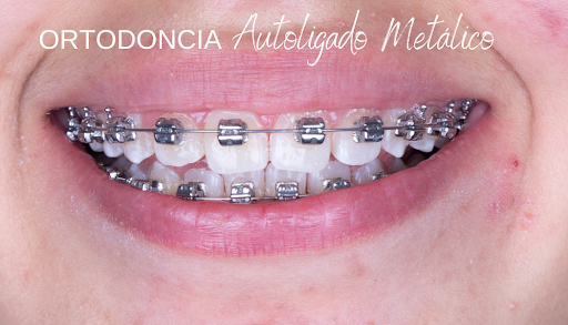 Dentalixt - Visual