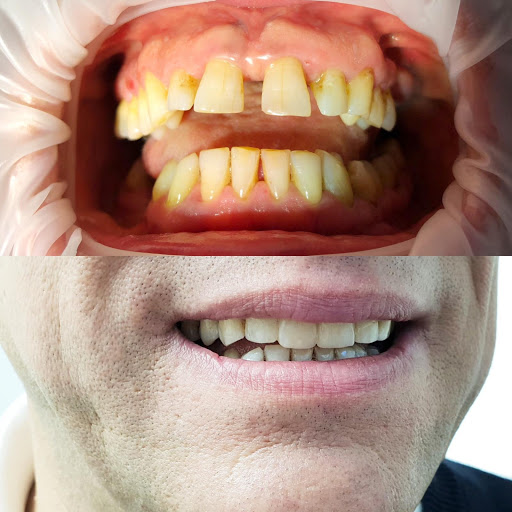 DentaNova - Visual