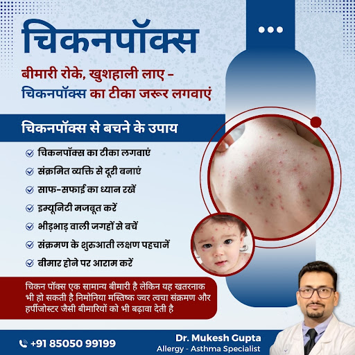Chickenpox: More Than Just an Itchy Rash!