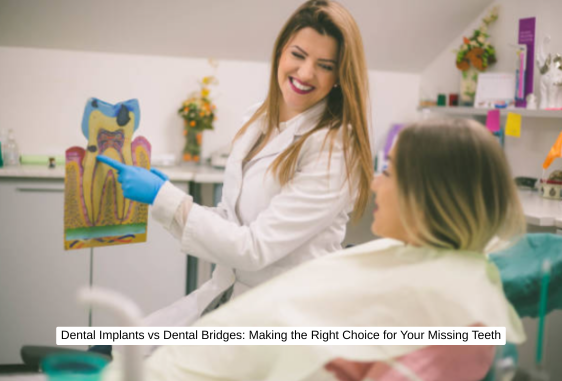 Dental Implants vs Dental Bridges: Making the Right Choice for Your Missing Teeth