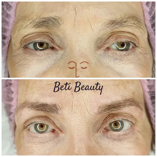 Beti Beauty estética - Thumbnail