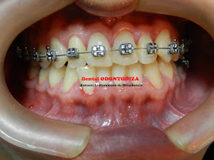 Clínica Dental ODONTODIZA 4