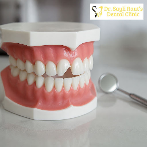 A cracked, chipped, or broken tooth might look minor at first, but delaying treatment can quickly…