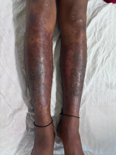 Public Health Alert from a Dermatologist ⚠️ post image