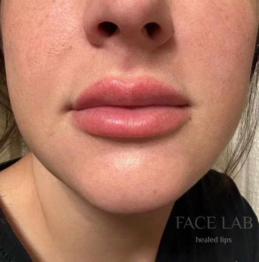 FACE LAB