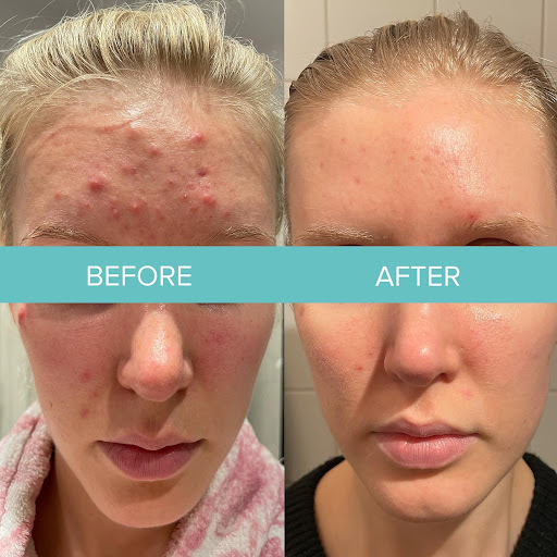 Lume Beauty Aesthetics - Thumbnail