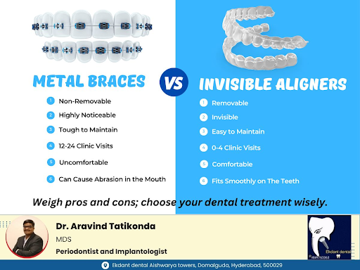Comparing traditional metal braces with clear aligners allows individuals to make an informed cho… post image