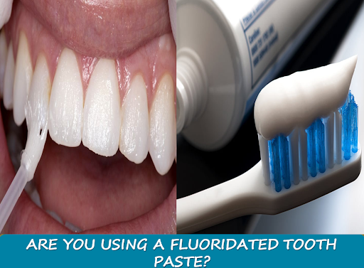 Fluoride is a mineral that occurs naturally in many foods and water sources, and it has been prov…