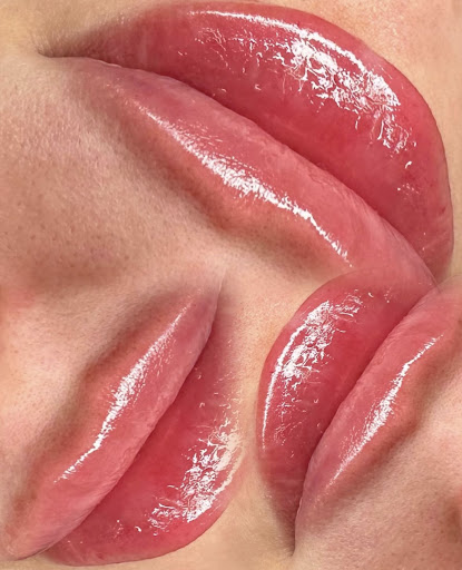 SKIN Aleksandra Poręba