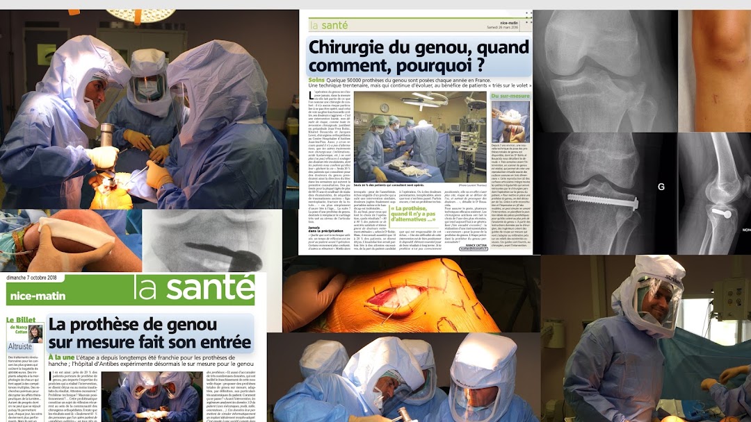 Arthrose du genou à Lyon - Chirurgie orthopédique - Prothèse