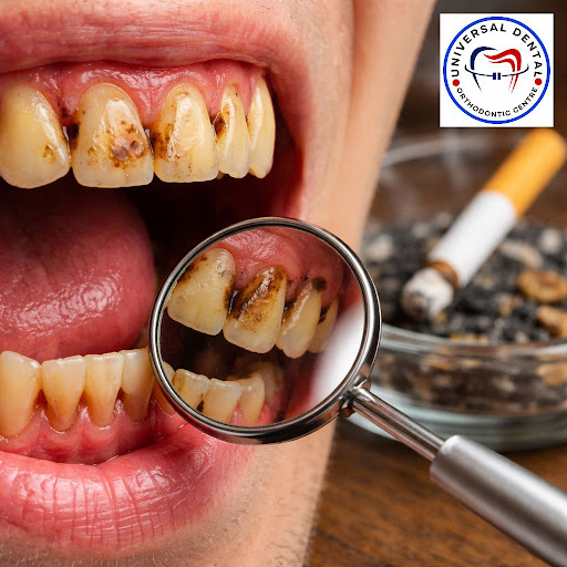 Smoking doesn’t just affect your lungs – it also silently damages your teeth and gums. At Univers… post image