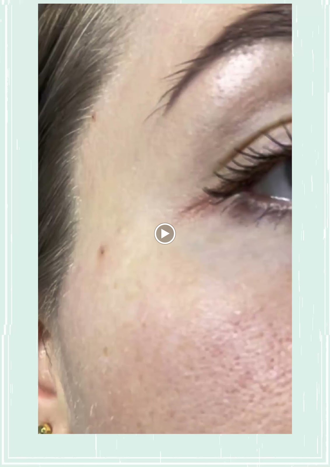 مركز لا ديرما الطبي - صورة 3