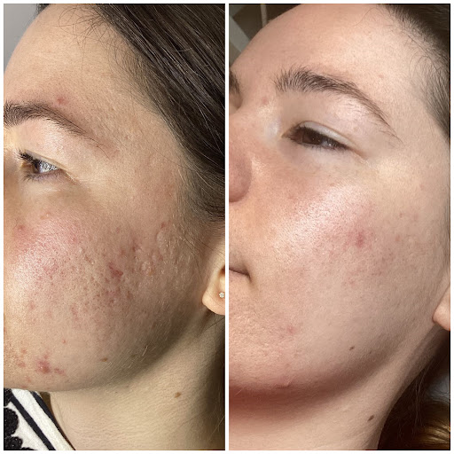 The Skin Genie Clinic