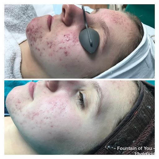 Fountain of You Skincare - Thumbnail