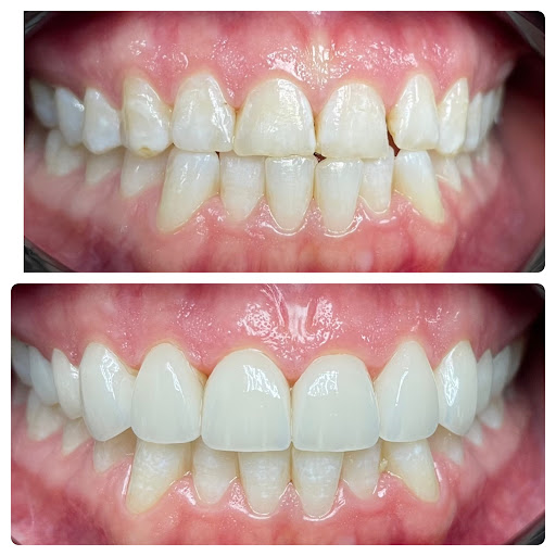 Collins St Dental of Arlington