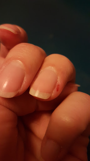 Shiny Nails Limburg - Thumbnail