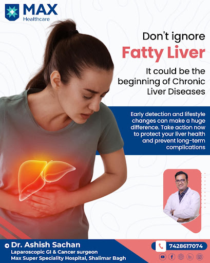 Don’t Ignore Fatty Liver: It Could Be the Start of Chronic Liver Disease. post image