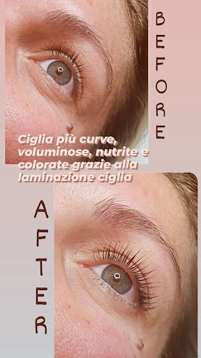Manuela Rota estetica - Thumbnail