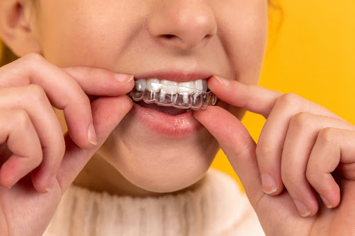 Orion's Dental: Dentist in Springvale - Thumbnail