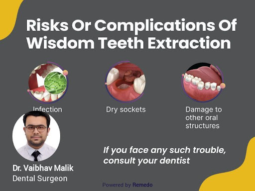 See your dentist if you have signs of infection after having your wisdom teeth removed or if you'… post image