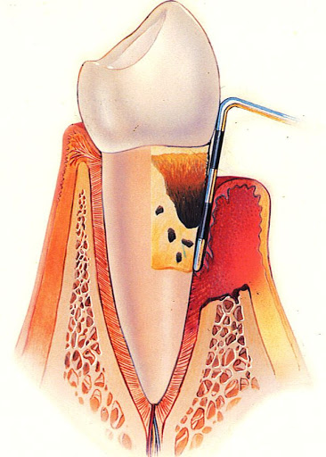 Dr. Cesar Garcia-Aguirre- Periodoncia y dentista