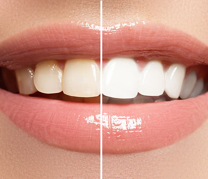 My Favorite Dentist - Thumbnail