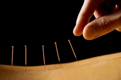 Lorenzini Acupuncture PLC