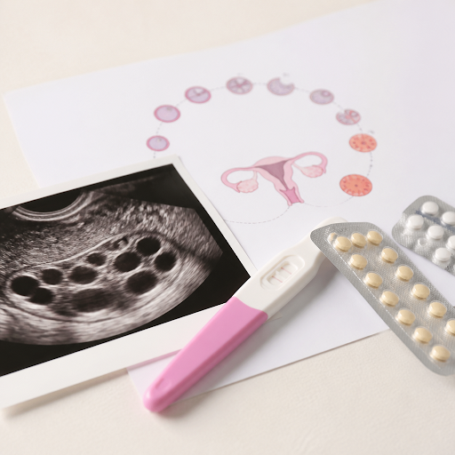Struggling to conceive can feel overwhelming, but the right guidance can make all the difference.… post image