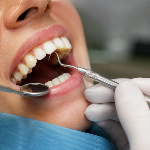 Healthy gums are the foundation of a beautiful smile. At PEARL DENTAL: We ensure you a healthy sm… post image