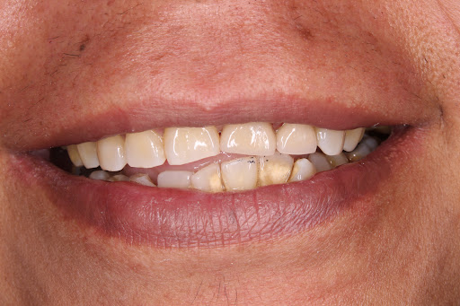 Dental Beauty - Creando Sonrisas Gallery - Mexico
