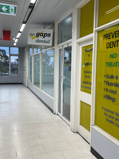No Gaps Dental Blacktown - Thumbnail