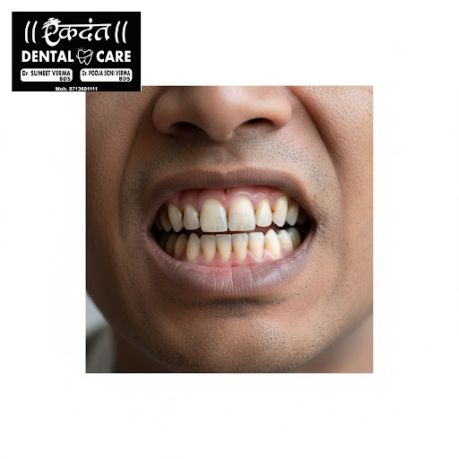 Smoking can have serious implications on your oral health, leading to gum disease, tooth decay, a… post image