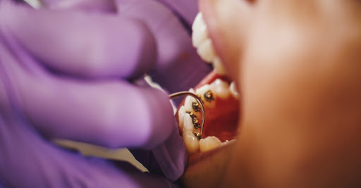 Dr Nicolas Najm - Orthodontie enfants et adultes - Thumbnail
