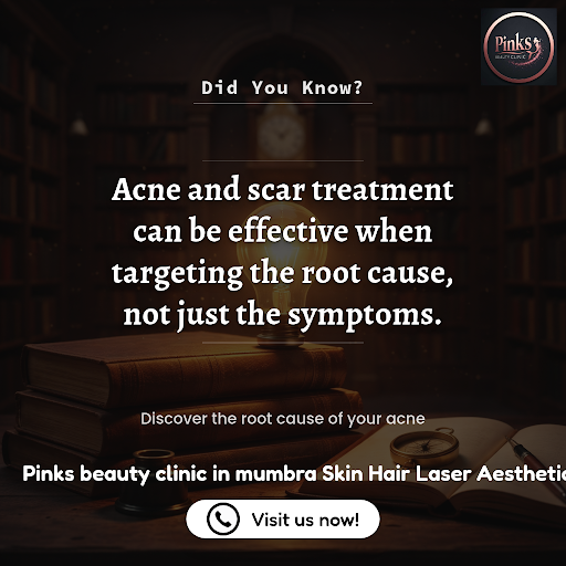 Acne & Scar Treatment post image