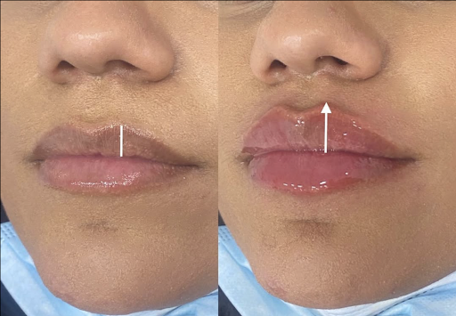 The Look Med Spa