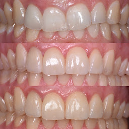 Photo n°6 de Dr Yannis Génique à Saverdun (Dentiste)