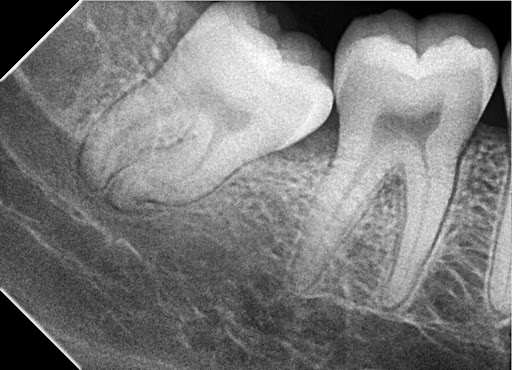 DENTAL URGENCIAS 24 HORAS. - DENTISTA 24 HORAS